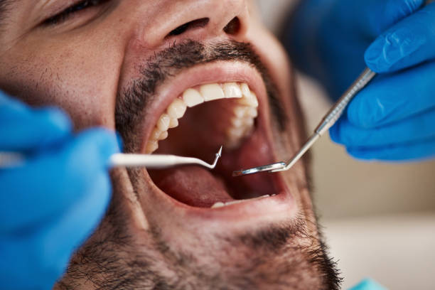 Best Weekend Emergency Dental Services in St Charles, MN
